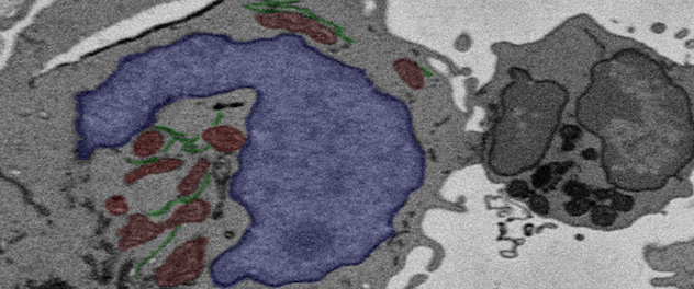 Serial block-face scanning electron microscopy (SBF-SEM) microscopy showing T-regulatory (Treg) organelles (red and green) and nuclear chromatin (blue)