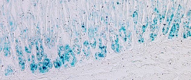 Microscopy showing blue cells that represent senescence-associated beta-galactosidase (SA-β-gal)-positive cells in murine stomach