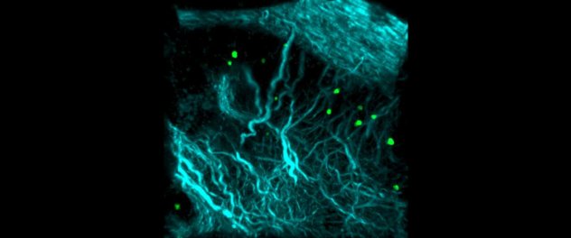 Microscopy depicts tissue fibrosis.