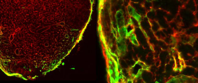 Microscopy depicts lymphoid tissues.