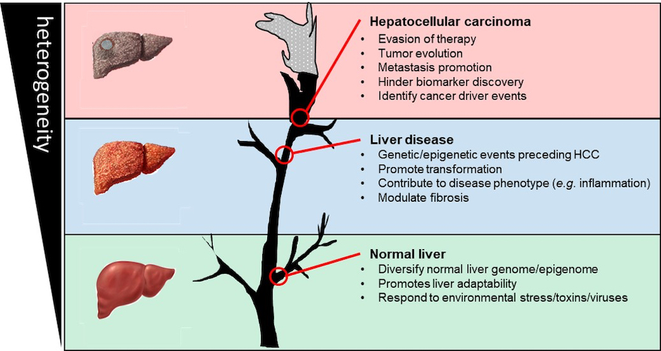 Model of the possible contribution of epigenetic heterogeneity to liver cancer