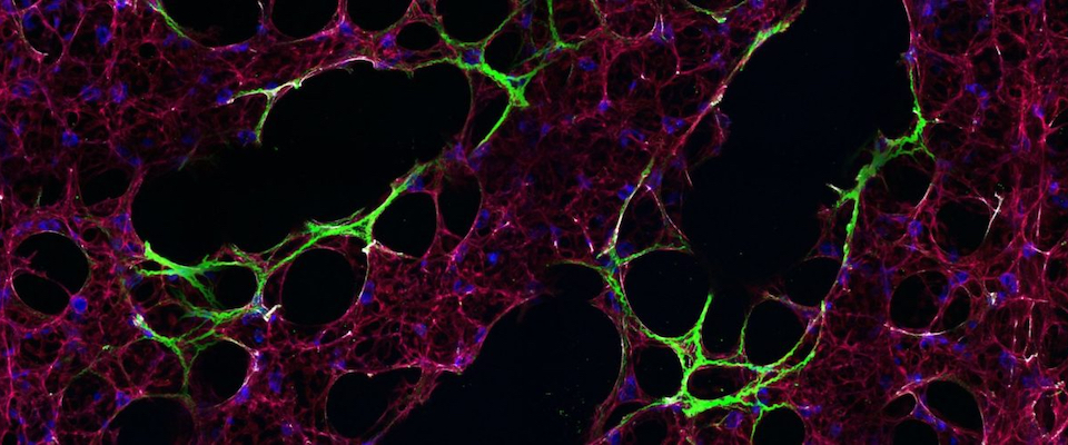 Confocal microscopy mapping construction of mouse lung