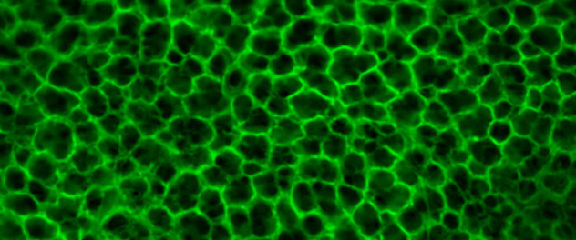 Microscopy showing alveolar architecture of the lung