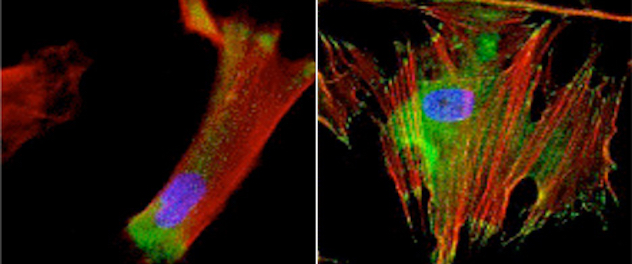 Microscopy showing human lung fibroblast in two panels contrasting soft versus stiff substrates