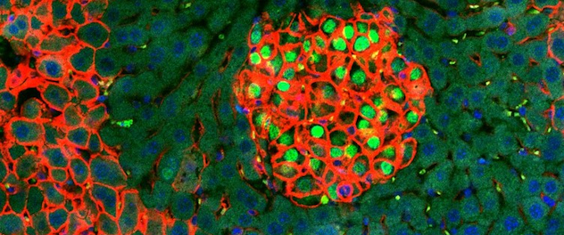 Fluorescence microscopy of a liver section