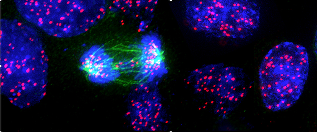 Microscopy of mitotic errors in a tumor cell