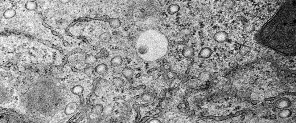 Electron micrograph of a primary rat hepatocyte