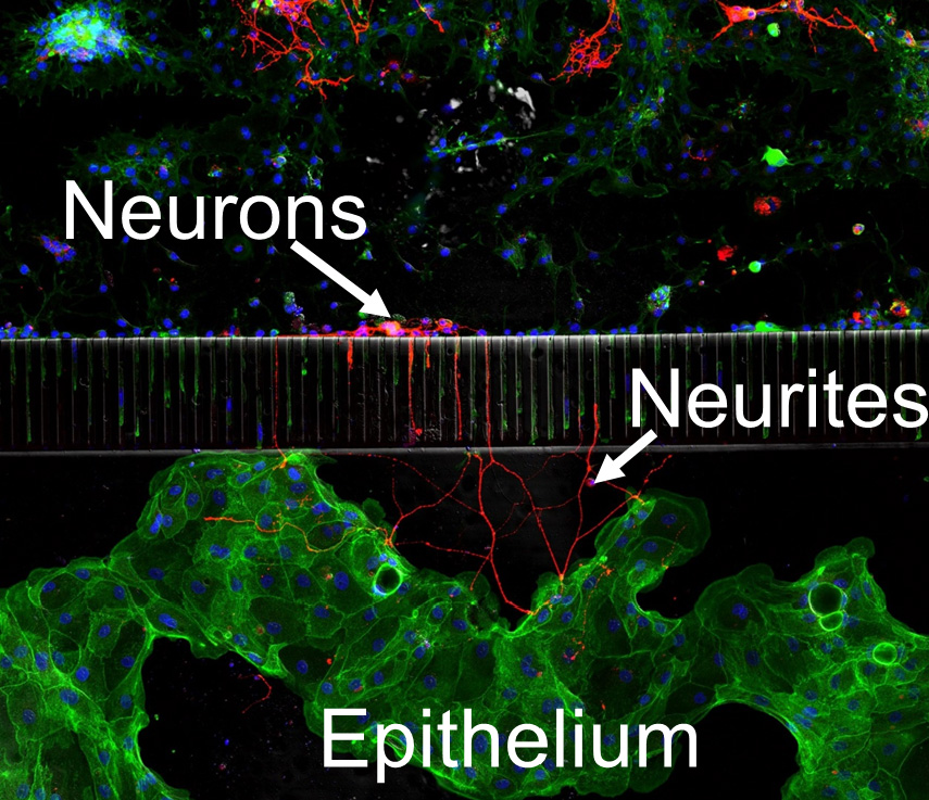 A fluorescent image shows two different cell types interacting in a microfluidic device