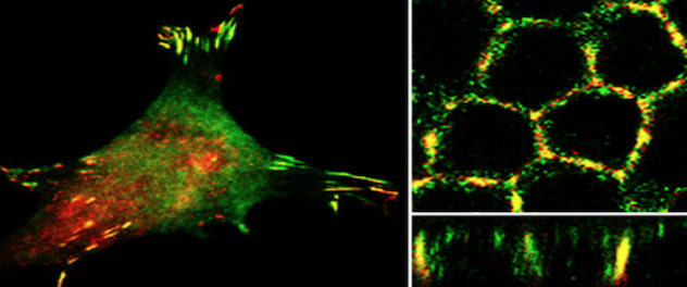 Three-panel microscopy showing cell-matrix adhesions (left) and cell-cell adhesions (right) from the top view (upper) or side view (lower)