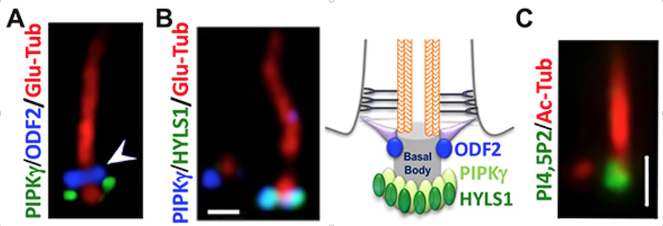 4-panel cilium diagram