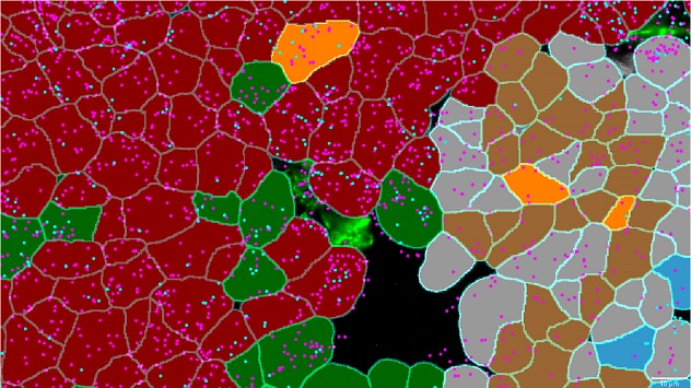 With the CosMx Spatial Molecular Imaging platform, each cell in this view was identified by studying transcript profiles. 