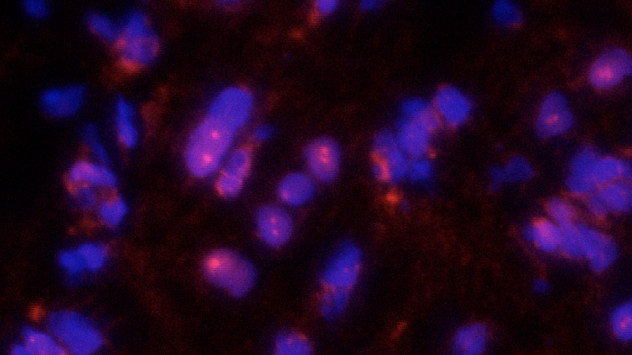 A microscopy photograph showing Nrf2 nuclear translocation in donor hearts after histone deacetylase inhibition